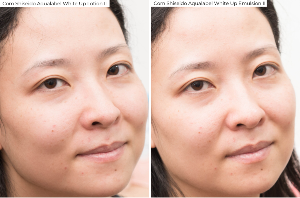 Aplicando o Shiseido Aqualabel White Up Lotion e Emulsion II no rosto. 