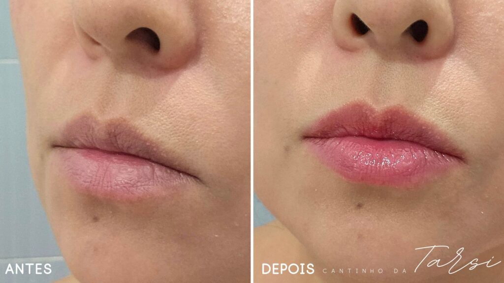 Antes & Depois: Brilho e cor sutil que Encanta